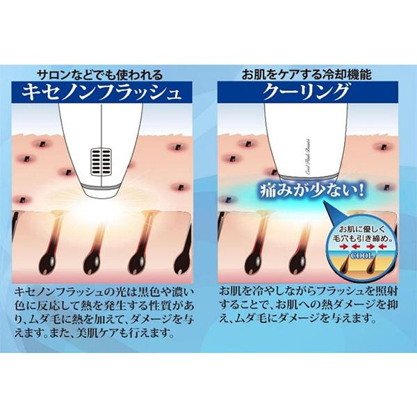 冷却脱毛器クールフラッシュボーテ 脱毛器 vio対応 メンズ 女性 男性 vio 自己処理 光脱毛 家庭用 家で脱毛 髭 脱毛 顔 ヒゲ 冷却 クール機能|micelle|04