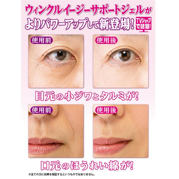 ウィンクルイージーサポートジェルex 目の下のたるみ解消 クリーム 眉間のシワ 化粧品 ほうれい線 目元のたるみ シワ 顔のたるみ解消 眉間のしわ 口コミ Gma57 1 美容と健康のミセルyahoo 店 通販 Yahoo ショッピング