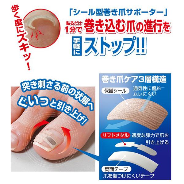宅配便送料無料 巻き爪の治し方 自分で ワイヤー クリップ 器具 テーピング テープ ロボ フットケア 日本製 口コミ 巻き爪シール2ヶ月ケア
