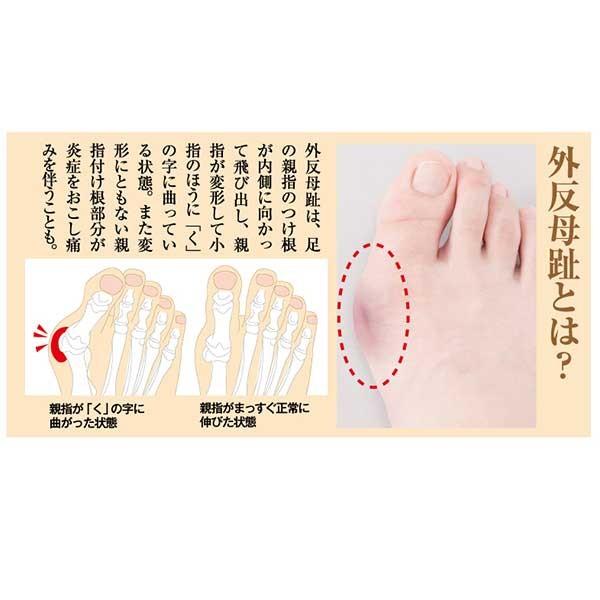 外反母趾の治し方 外反母趾サポーター 痛い テーピング サポーター 効果 口コミ ケア 両足用 外反母趾対策用品 Dr 福岡の寝ながら 外反母趾サポーター 片足用 Gran 356 美容と健康のミセルyahoo 店 通販 Yahoo ショッピング