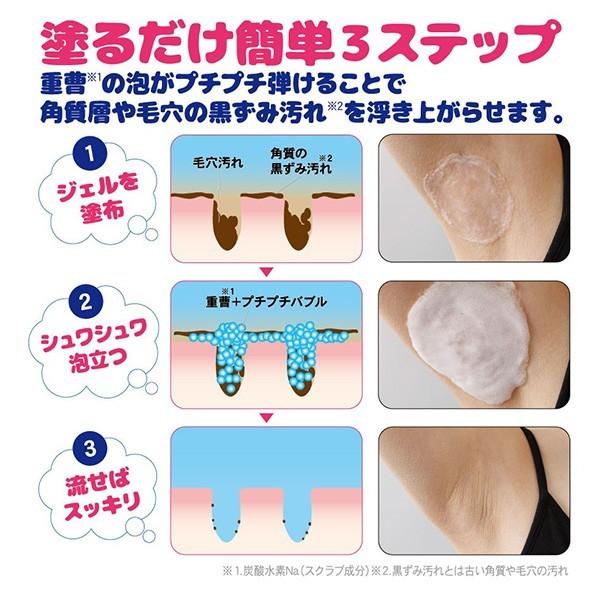 2個セット 脇の黒ずみ 脇の匂い対策 毛穴 黒ずみ 臭い 脇 ピーリング 重曹 角質 汚れ 脇の毛穴の黒ずみ 口コミ ぷっくぷく重曹ワキ泡プレミアムパック 30g Nks265 2 美容と健康のミセルyahoo 店 通販 Yahoo ショッピング