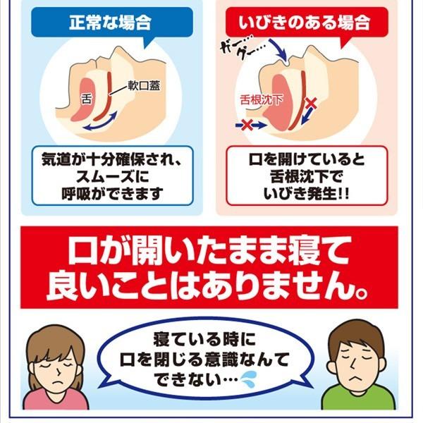 2個セット いびき グッズ いびき防止 いびきをかかない方法 対策 新色追加 防止 スヤスヤナイトフィルム 30枚 いびき防止グッズ 口コミ テープ いびき防止テープ