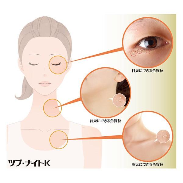 首のイボ 取り クリーム 目の周り 白いポツポツ 角質粒 顔と首 加齢 老人性 首周り 除去 ポツポツ ボディローション ハトムギ 口コミ ツブ ナイトk ローション Sei504 1 美容と健康のミセルyahoo 店 通販 Yahoo ショッピング