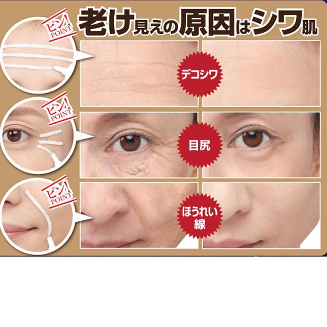 2個セット 目の下のたるみ解消 クリーム 男性 女性 おでこ シワ ほうれい線 たるみ 目元のたるみ おでこのシワ 医薬部外品 薬用シワハールex 30g Sei736 2 美容と健康のミセルyahoo 店 通販 Yahoo ショッピング