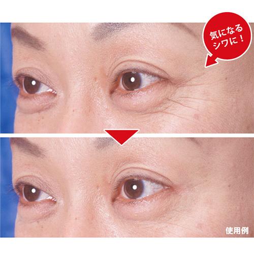 口元 シワ対策 しわ伸ばしテープ トレーニングシート 部分用フェイスパック 目じりのしわ フラウニーズ 目尻 口元用 144ピース入り Frownies Sun403 1 美容と健康のミセルyahoo 店 通販 Yahoo ショッピング