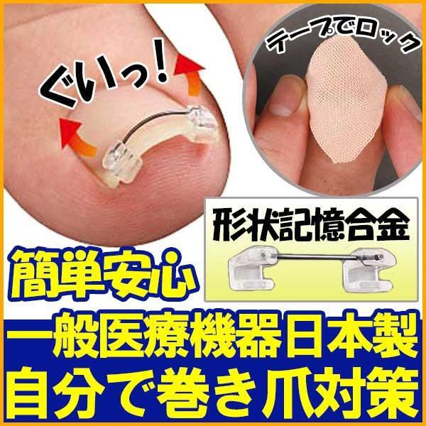巻き爪 治し方 自分で 巻き爪クリップ 巻き爪 矯正器具 グッズ 矯正 フット