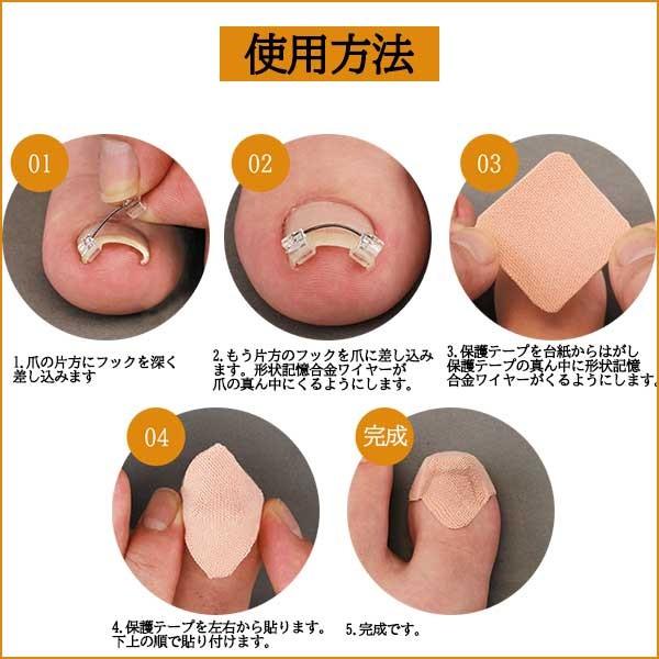 2個セット 一般医療機器 巻き爪ワイヤーガード 巻き爪 治し方 自分で 巻き爪クリップ 巻き爪 矯正器具 グッズ 矯正 フットケア 口コミ :sun63-2:美容と健康のミセルYahoo!店 - 通販 - Yahoo!ショッピング 2個セット 一般医療機器 巻き爪ワイヤーガード 巻き爪 治し方 自分で 巻き爪クリップ 巻き爪 矯正器具 グッズ 矯正 フットケア 口コミ :sun63-2:美容と健康のミセルYahoo!店 - 通販 - Yahoo!ショッピング