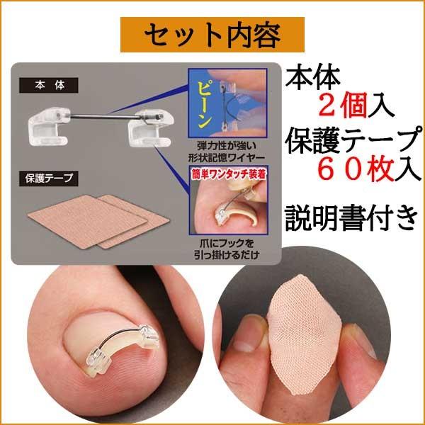 2個セット 一般医療機器 巻き爪ワイヤーガード 巻き爪 治し方 自分で 巻き爪クリップ 巻き爪 矯正器具 グッズ 矯正 フットケア 口コミ :sun63-2:美容と健康のミセルYahoo!店 - 通販 - Yahoo!ショッピング 2個セット 一般医療機器 巻き爪ワイヤーガード 巻き爪 治し方 自分で 巻き爪クリップ 巻き爪 矯正器具 グッズ 矯正 フットケア 口コミ :sun63-2:美容と健康のミセルYahoo!店 - 通販 - Yahoo!ショッピング
