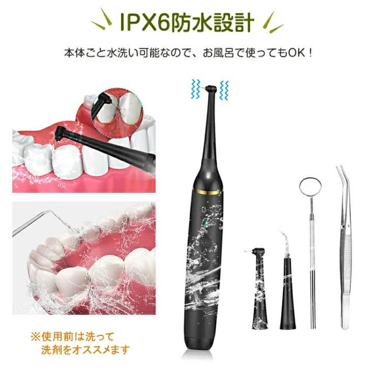 一年間保証】口腔洗浄器 充電式 超音波 歯石取り 自分 歯石 除去 電動