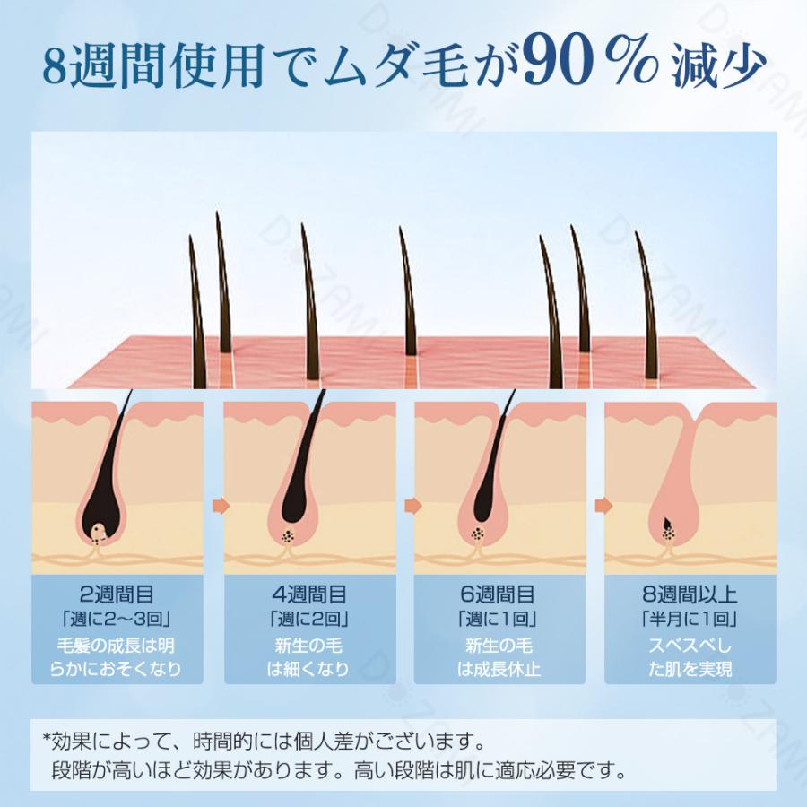 脱毛器 全身ケア だつもうき メンズ/レディース 無制限照射回数 VIO