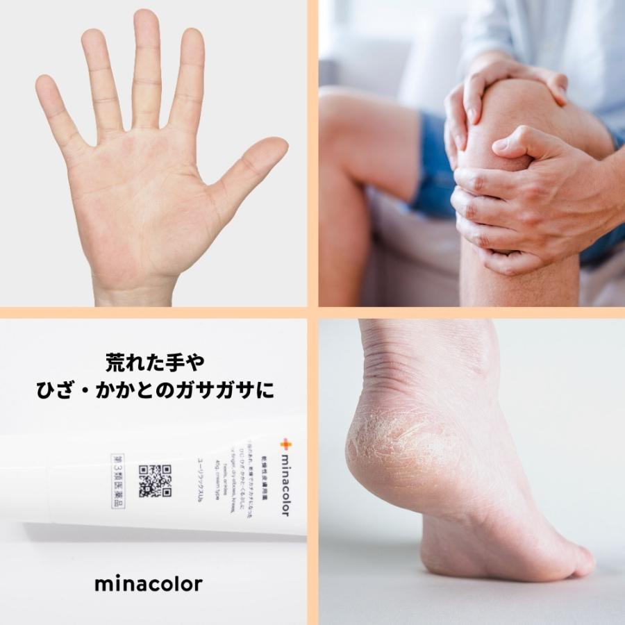 年新発売 ユーリラックスub 45g 尿素クリーム サメ肌 手指のあれ 角化症 第3類医薬品 M ミナカラ薬局yahoo ショッピング店 通販 Yahoo ショッピング