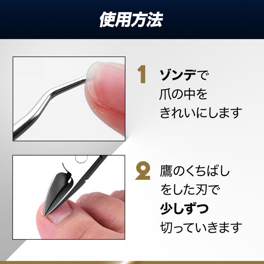 爪切り ニッパー 巻き爪 硬い爪 厚い爪 深爪 ゾンデ 介護用 高齢者 :tumekiri1:Perfect Free - 通販 - Yahoo!ショッピング 爪切り ニッパー 巻き爪 硬い爪 厚い爪 深爪 ゾンデ 介護用 高齢者 :tumekiri1:Perfect Free - 通販 - Yahoo!ショッピング
