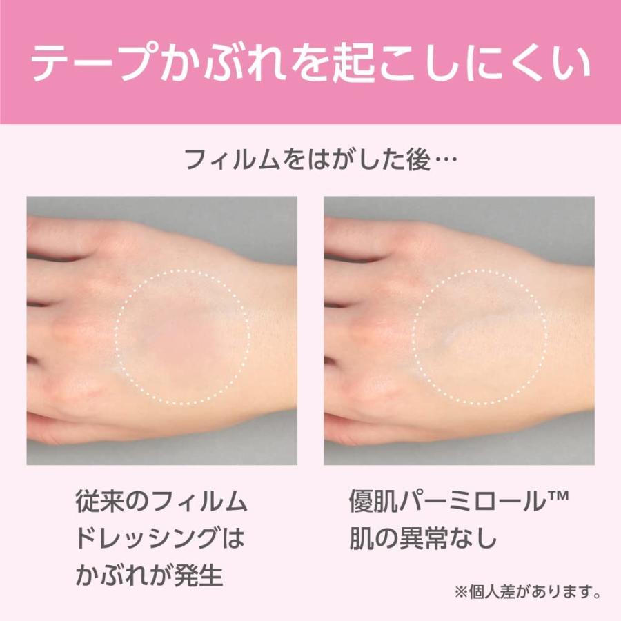 激安通販専門店 ニトムズ 優肌パーミロール 肌にやさしい かぶれにくい防水フィルム 15cm 10m 14r15 Angkorgreen Com Kh
