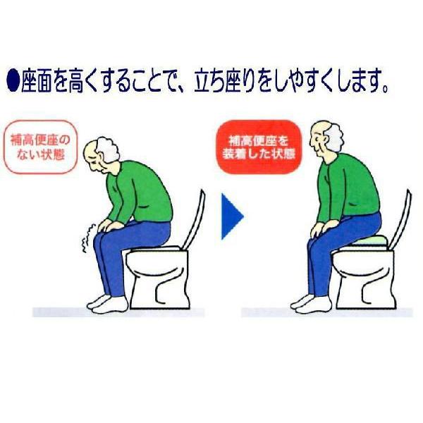 補高便座 #10（10cm補高）535-270 ＜アロン化成＞_5