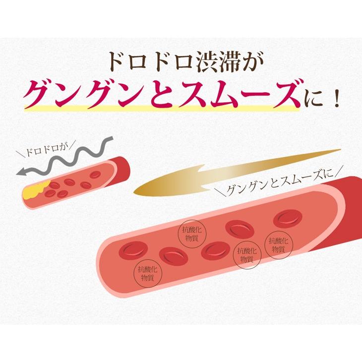最大78 Offクーポン むくみ サプリ サプリメント ケア むくみ解消 ムクミ 脚 足 太もも 顔 下半身 ふくらはぎ Opcサプライズプレミアム 360粒入り 1瓶 Rmladv Com Br