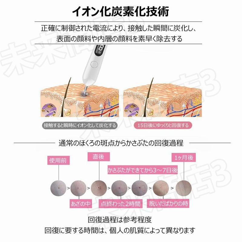 最新版 レーザーそばかす除去 ほくろ除去ペン レーザー除去ペンレーザー ペン スポットペン 家庭用 ほくろ除去液晶ペン ビューティーインアース リムーバーペン Xilo 48 未来商店3 通販 Yahoo ショッピング