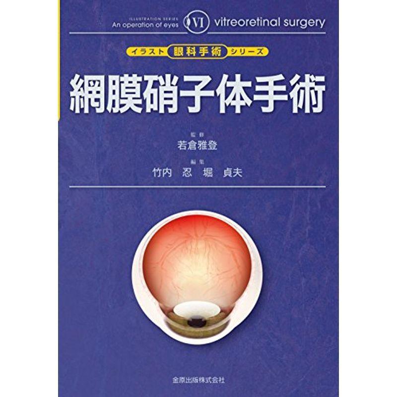 安い直販店 網膜硝子体手術 イラスト眼科手術シリーズ 6 us Mkヤフー店 売品 Foodiesplace Com