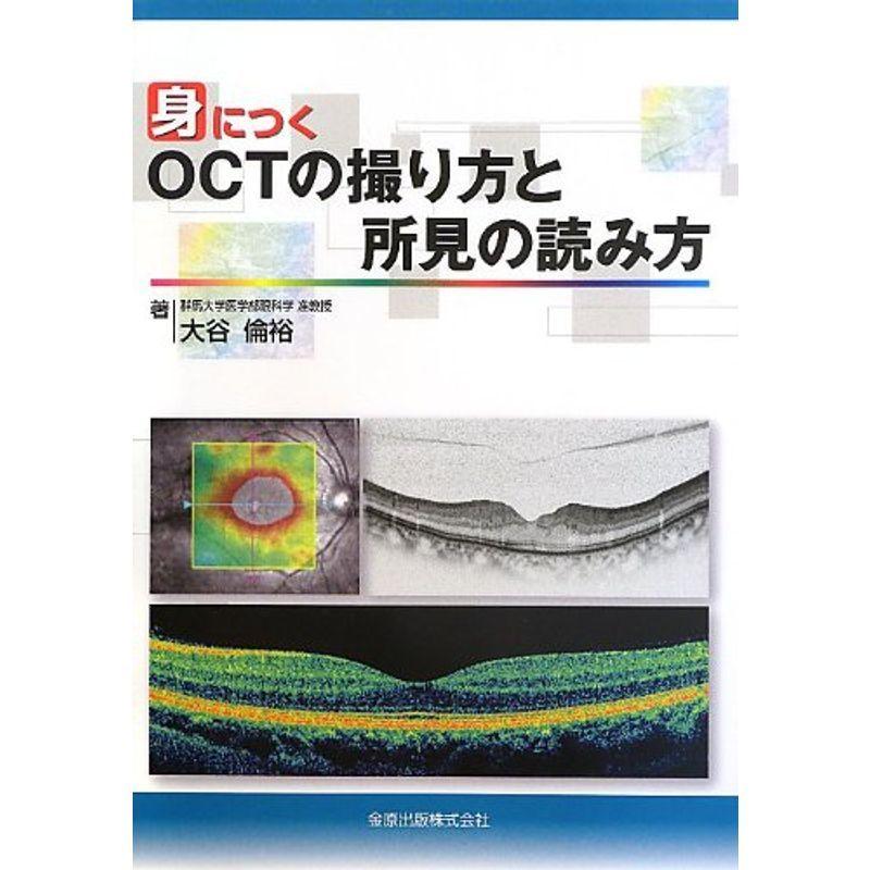 眼科スゴ技 白内障手術: WEB動画付き 75本 第一線で活躍するサージャン