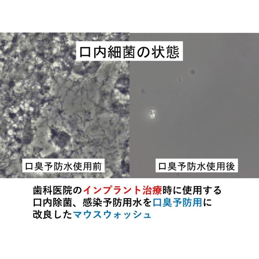 ペット口臭ケア ペット口臭対策 ペット消臭剤 ペット消臭スプレー ペット消臭マット ペット消臭元　ペット用口臭SOS 日本製 30ml　 |  | 02