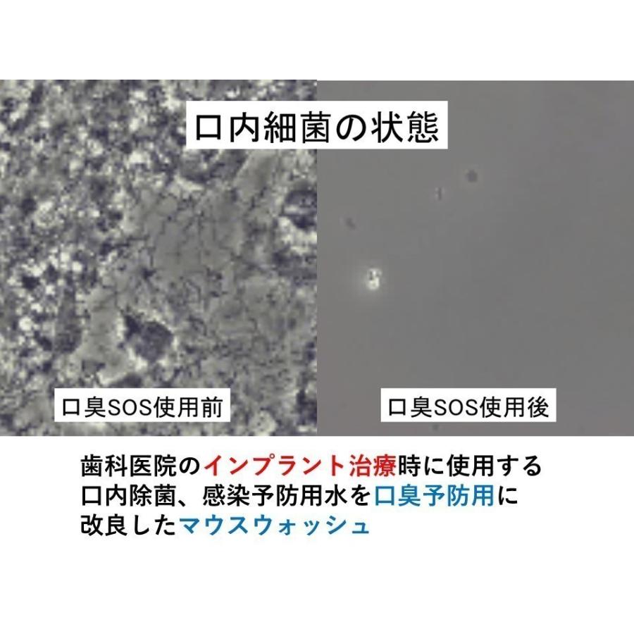 口臭ケア  口臭対策 口臭予防 口臭の原因 口臭を消す  口臭チェッカー 口臭サプリ 口臭　マウスウォッシュ 　舌苔【 口臭SOS 】 携帯用100ml |  | 04