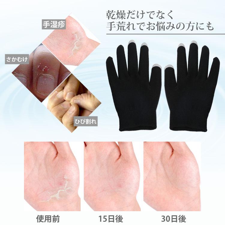 ハンドケア 保湿 手袋 ブラック 美容成分配合 スマホ対応 ゲル 手荒れ