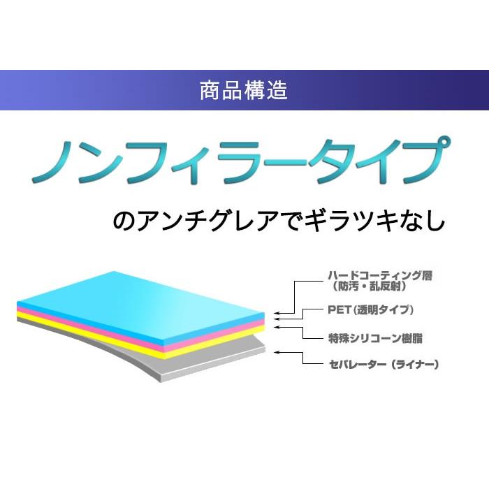 SIGMA dp1 アクセサリーの商品一覧 通販 - Yahoo!ショッピング SIGMA dp1 アクセサリーの商品一覧 通販 - Yahoo!ショッピング