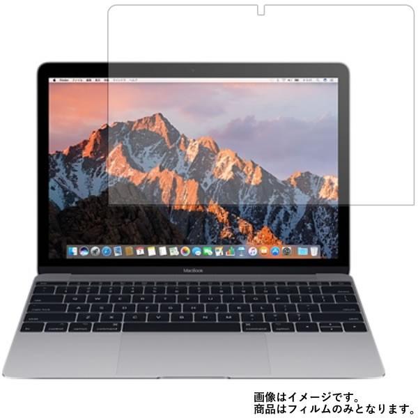 2026年6月】macbook 12インチ（MacBook）のおすすめ人気ランキング