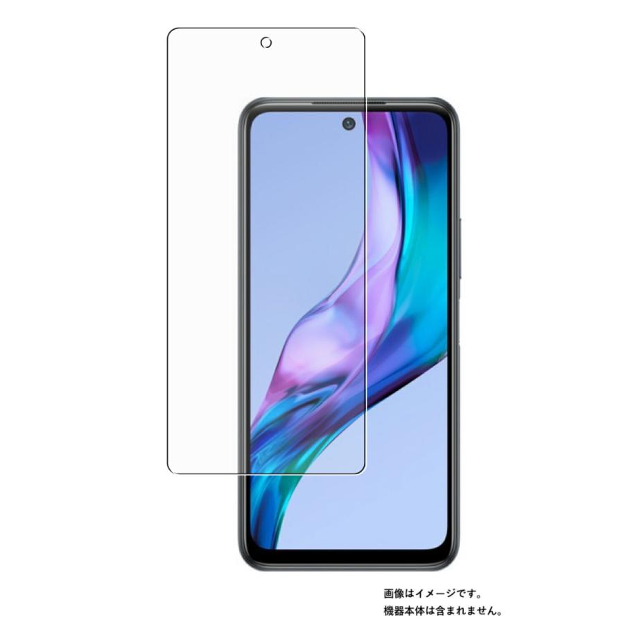Xiaomi Redmi Note 10T 用 アンチグレア・ブルーライトカットタイプ
