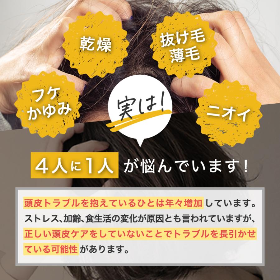 頭皮保湿ローション フケ かゆみ 頭皮臭 乾燥 薄毛 抜け毛 対策 医薬部外品 頭皮ケア 男女兼用 発毛促進 育毛成分 保湿効果 皮膚炎 湿疹 脂漏性 2本 60mL/60mL | modest | 06