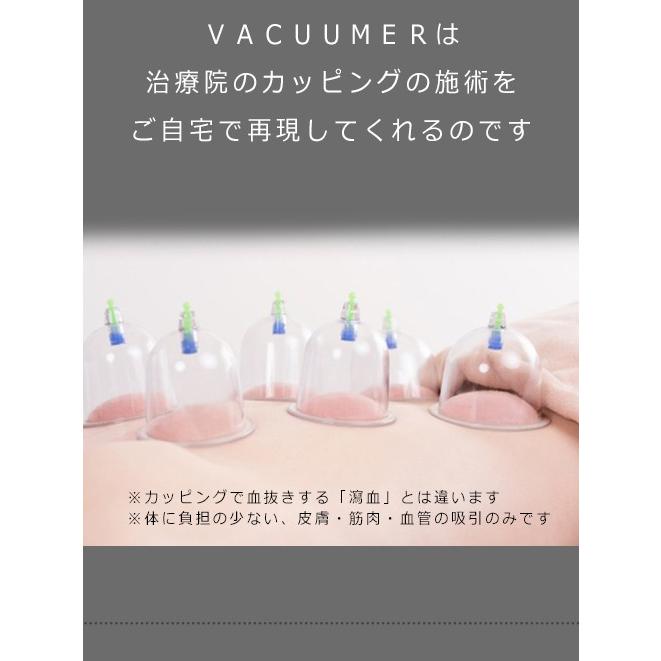 カッピング 吸い玉 全身バキューマー ハード （4個入り）磁気付きカッピング 送料無料 人気 首こり  スライドカッピング｜mogoshop｜12