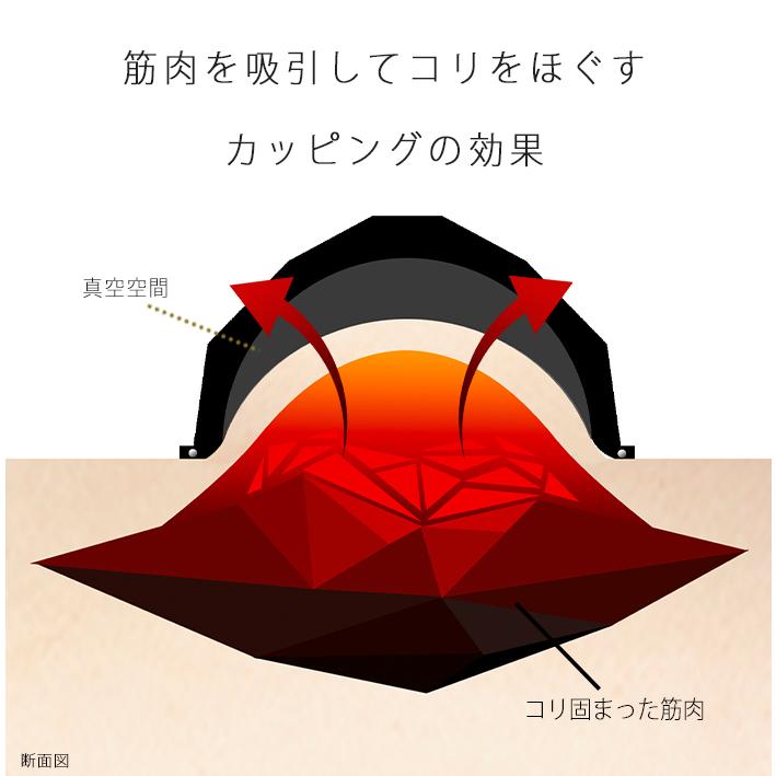カッピング VACUUMER UNIVERSE SOLID　バキューマーユニバース　ソリッド　肩こり解消　ツボ　吸い玉 |  | 12