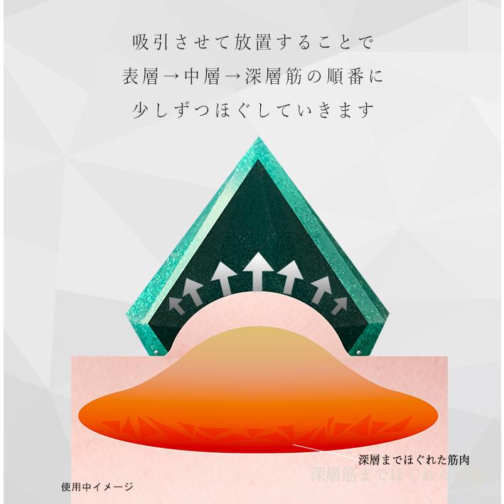 カッピング　VACUUMER UNIVERSE CARAT |  | 15