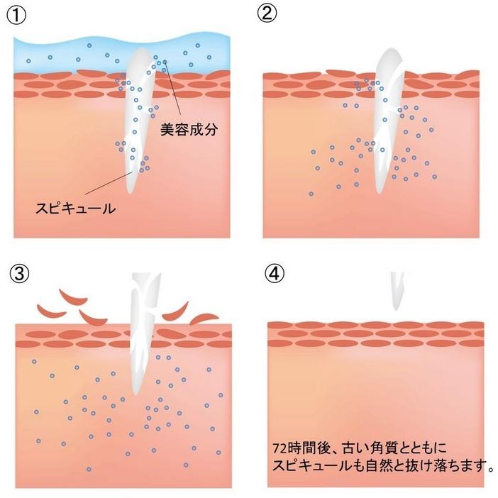 SCボーテ SCbeaut'e プレミアム インジェクション 6本 外箱なし