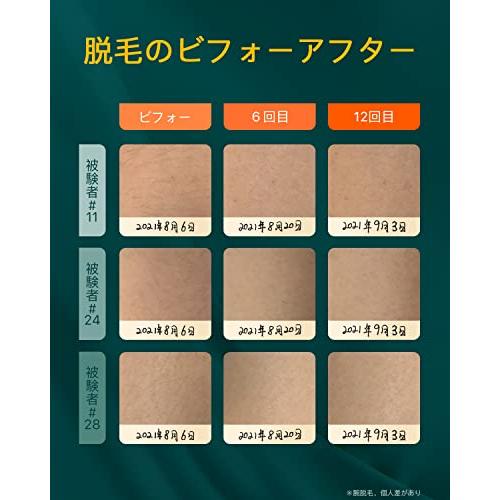 大人気 JOVS X2 脱毛器 メンズ 髭 だつもうき脱毛器 レディース vio対応 家庭用 光脱毛器 無制限回照射 サファイア 冷却機能 無痛 全身用 IP 【1497102467】(53574円)