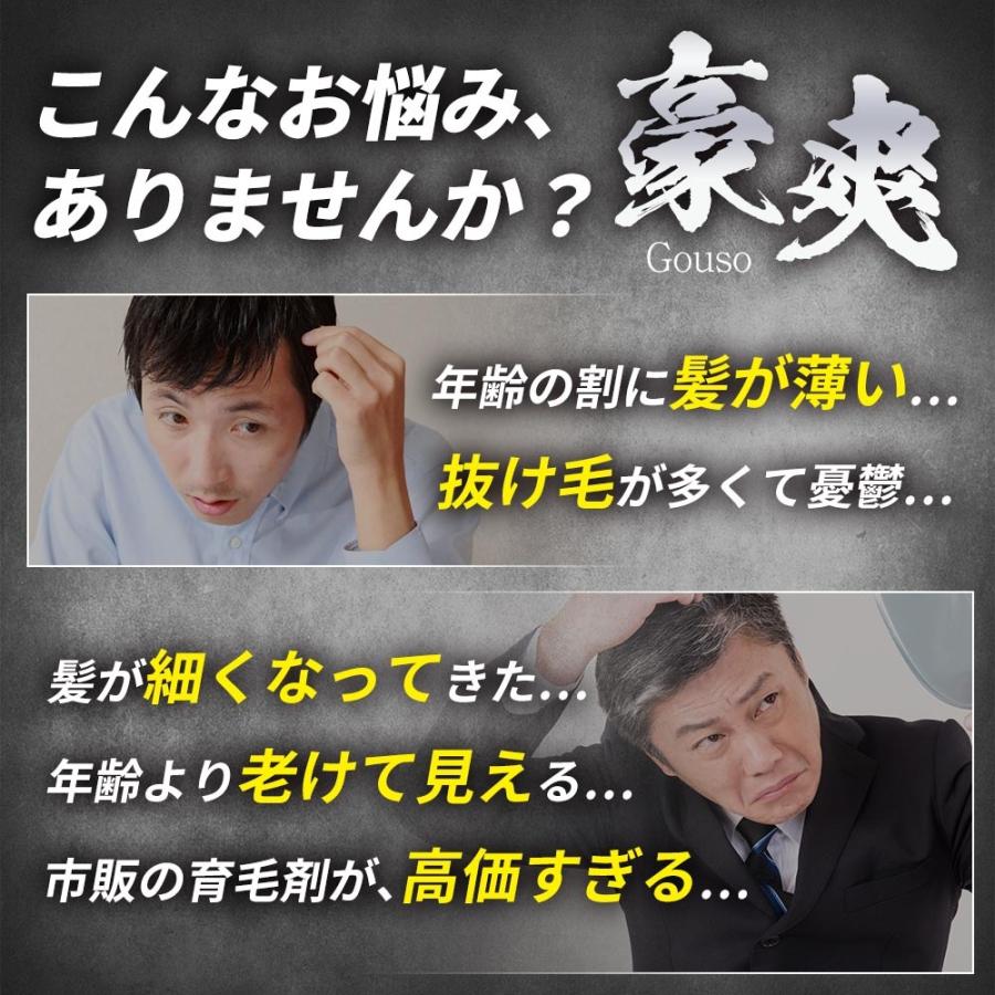 【6本おまとめ割引】 育毛剤 豪爽 薬用育毛剤 育毛トニック 発毛剤 スカルプ 育毛 薄毛 男性用 ヘアケアソムリエ美容師 育毛マッサージ マニュアル付 医薬部外品_11