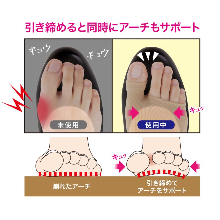 外反母趾 薄型 サポーター 足指 広げる 矯正  矯正グッズ 矯正サポーター  Makuake  外反母趾薄型サポーター 送料無料 ポイント消化 |  | 11