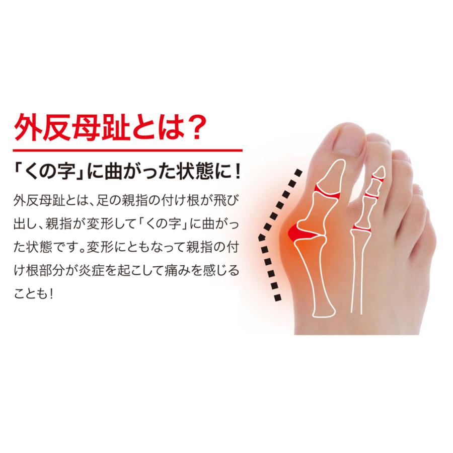 外反母趾 薄型 サポーター 足指 広げる 矯正  矯正グッズ 矯正サポーター  Makuake  外反母趾薄型サポーター 送料無料 ポイント消化 |  | 04
