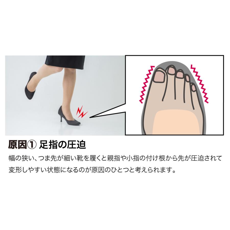 外反母趾 薄型 サポーター 足指 広げる 矯正  矯正グッズ 矯正サポーター  Makuake  外反母趾薄型サポーター 送料無料 ポイント消化 |  | 05
