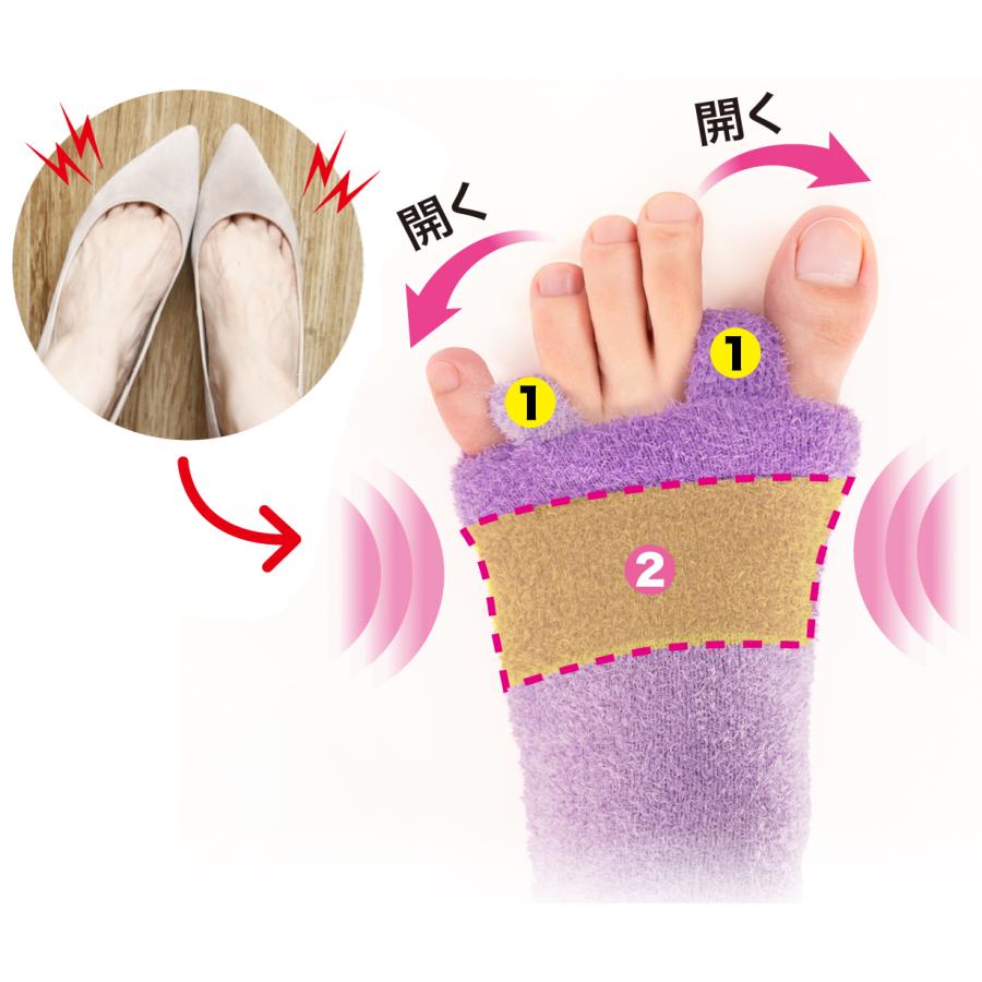 【ロングタイプ】 外反母趾 内反小趾 サポーター 足指 広げる 矯正  矯正グッズ 矯正サポーター  Makuake  外反母趾おやすみサポーター 送料無料 |  | 05