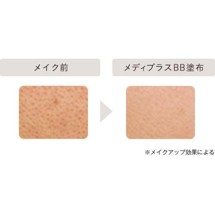 Mediplus（メディプラス） メディプラスBB 内容量17g (約2ヶ月分