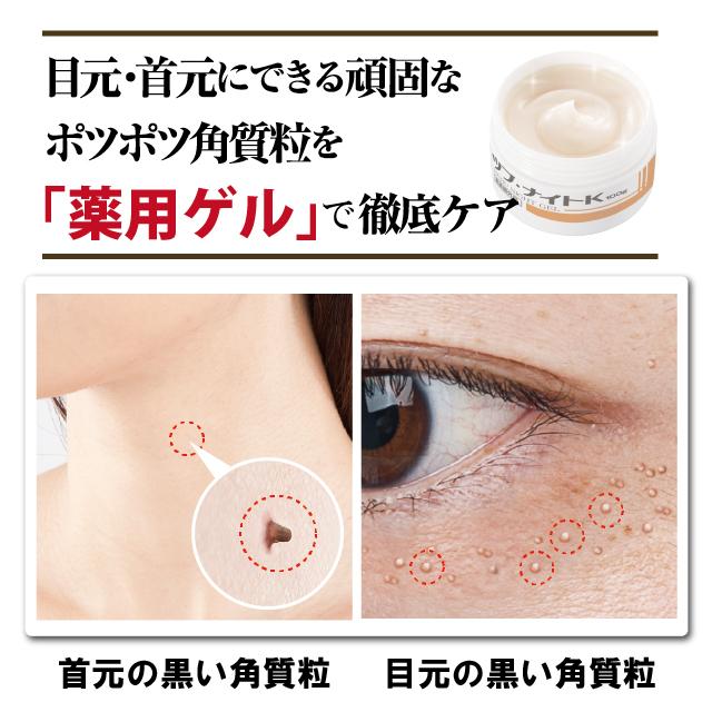 薬用ツブ・ナイトK ゲル　ツブナイト クリーム スキンケア 目元 角質粒 ポツポツ 医薬部外品 シェモア | ツブ・ナイトK | 01