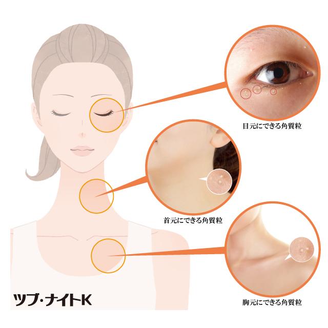 ツブ・ナイトK クレイソープ 　　石鹸 スキンケア 角質粒 ポツポツ 目の周り 首元 胸元 化粧品 シェモア | ツブ・ナイトK | 02