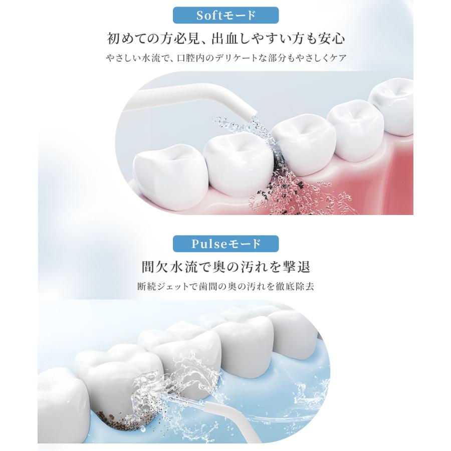 「クーポンで最安3068円」タレント筧美和子さん推薦 口腔洗浄器 ジェットウォッシャー 口腔洗浄機 大容量水タンク 5本ノズル 舌クリーナー付 360°回転 爆買 | EPEIOS | 09