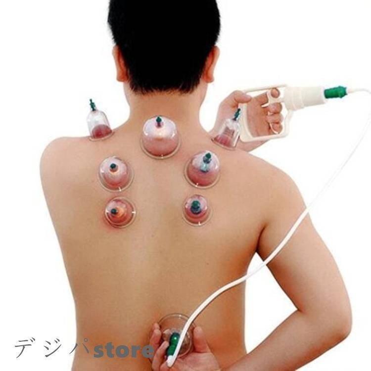 エアマッサージ器 吸い玉カップ ハンソルメディカル ポンプ マッサージ