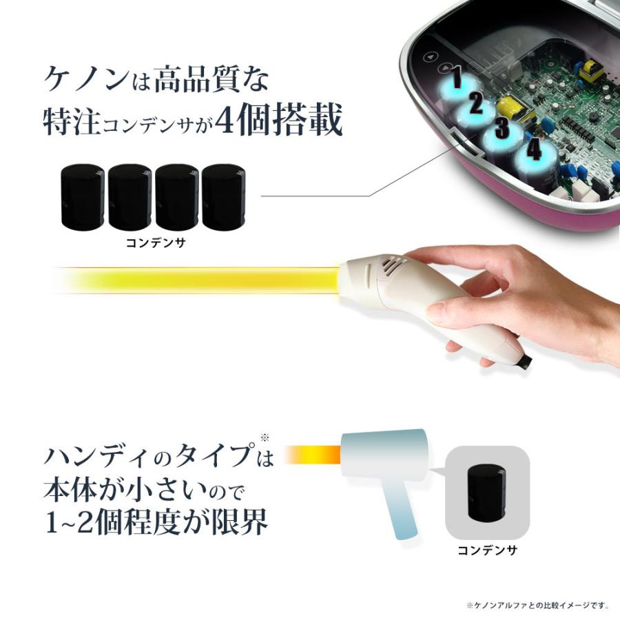 脱毛器ランキング1位 ケノン ke-non 光美容器 ギフト 脱毛器ランキング1位 ケノン ke-non 光美容器 ギフト