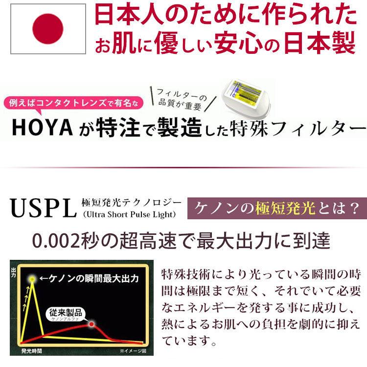 2024年ストロング2初解禁 ケノン 公式 最新型 新品 正規品 脱毛器 ランキング 1位 日本製 光美容器 全身 髭 VIO 対応 脱毛器具 産毛 USPL｜mrock｜07