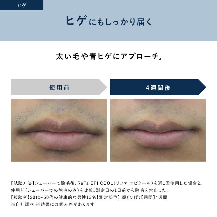 ReFa（リファ） ○公式ストア○ エピ クール 光美容器 公式 ムダ毛