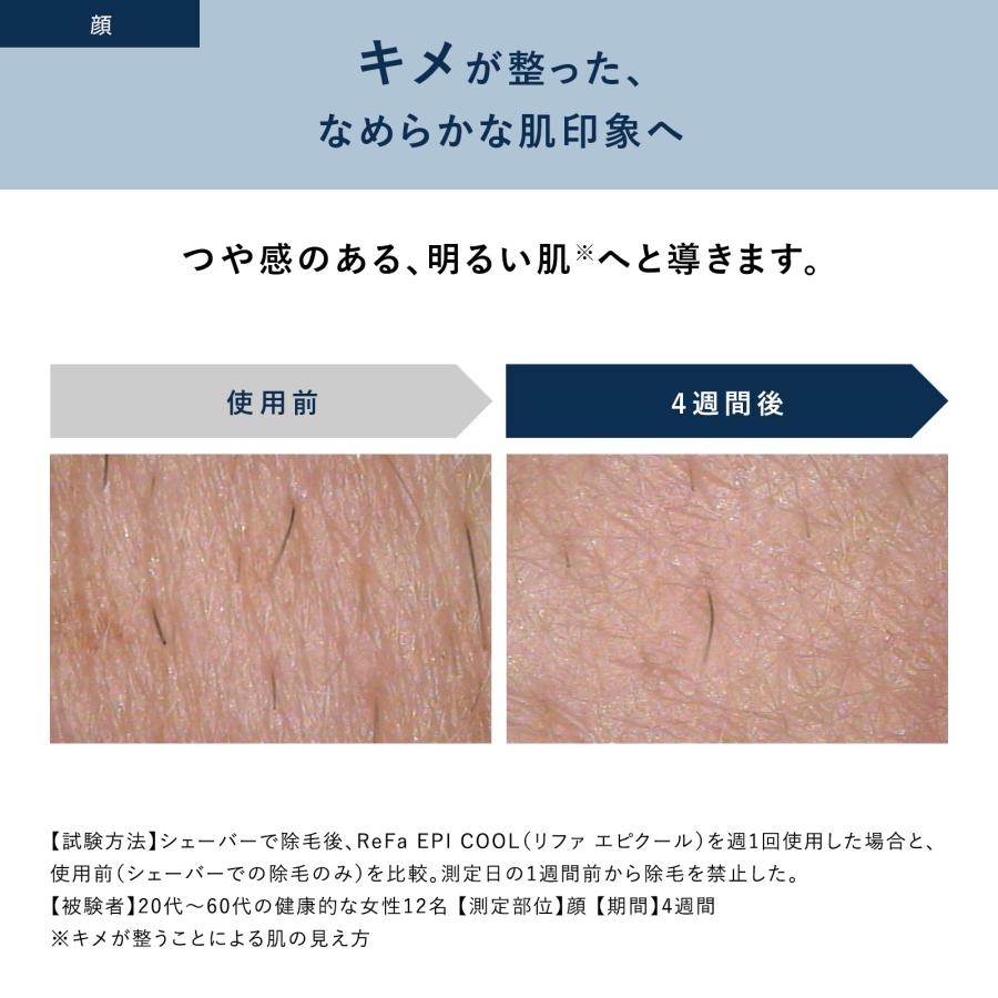 ReFa（リファ） ○公式ストア○ エピ クール 光美容器 公式 ムダ毛