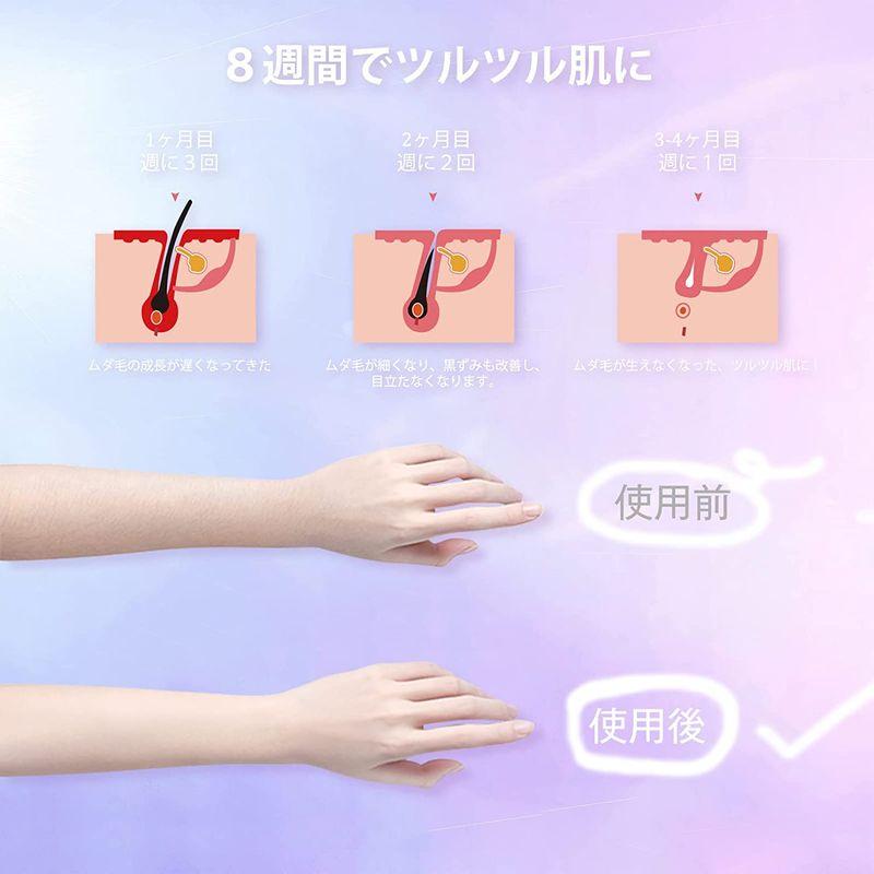 SALE／90%OFF】 2023業界新登場 UV殺菌ベース付き 脱毛器 全身脱毛