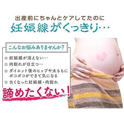 マイマ Maima マタニティクリーム 妊娠線予防 肉割れ 産前 産後のボディクリーム 100g 妊娠線ケア 保湿 無添加 妊娠線クリーム Www Ramnurtextile Com